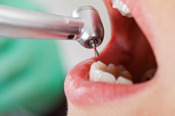 Best Holiday Emergency Dentist in Fort Bliss, TX
